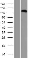 C16orf62 Protein (Over-Expression Lysate Myc-DDK (Flag))