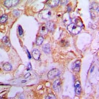 HDC / Histidine Decarboxylase Antibody