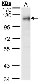 Polyclonal Rabbit anti-Human RRBP1 / hES Antibody (aa1183-1410, IHC, WB)