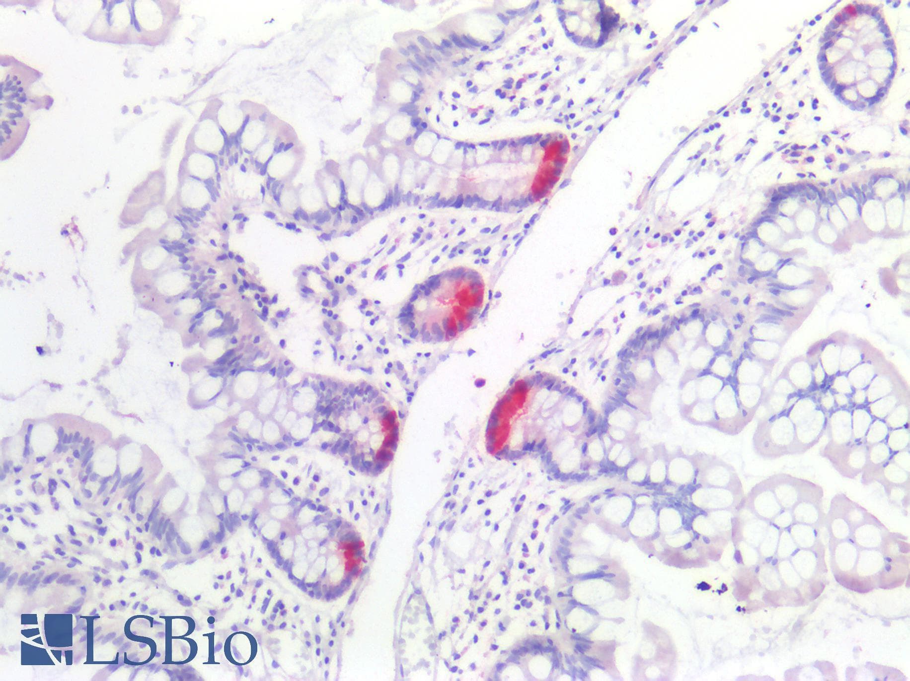 PathPlus™ PRSS1 / Trypsin Antibody
