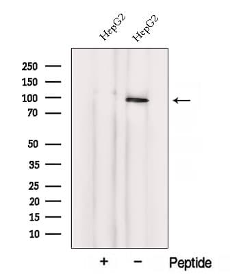 Polyclonal Rabbit anti-Human VPS41 Antibody (aa119-223, IF, WB)