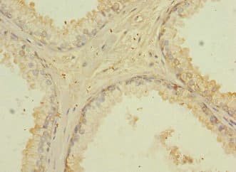 CD276 / B7-H3 Antibody