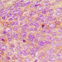 IHC-plus™ DEFA1 / Defensin Alpha 1 Antibody (Internal)