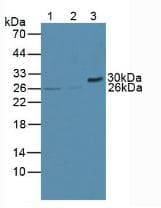 BCL2 / Bcl-2 Antibody (aa2-211)