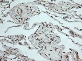 NOTCH1 Antibody (clone OTI3E12)