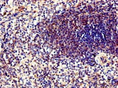 Polyclonal Rabbit anti-Human PPP6C Antibody (IHC, IF)