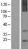 AGTRAP / ATRAP Protein (Over-Expression Lysate Myc-DDK (Flag))