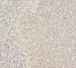 Polyclonal Rabbit anti-Human PSTPIP1 Antibody (IHC, WB)