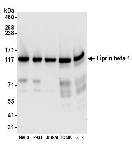Polyclonal Rabbit anti-Human PPFIBP1 Antibody (aa175-225, WB)