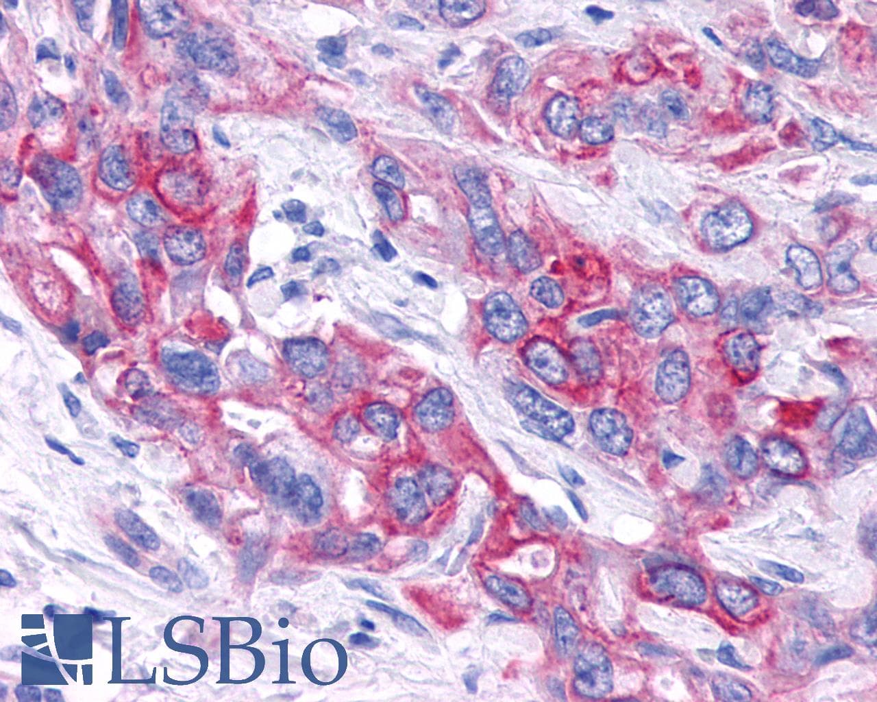 PathPlus™ VPAC2 / VIPR2 Antibody (C-Terminus)