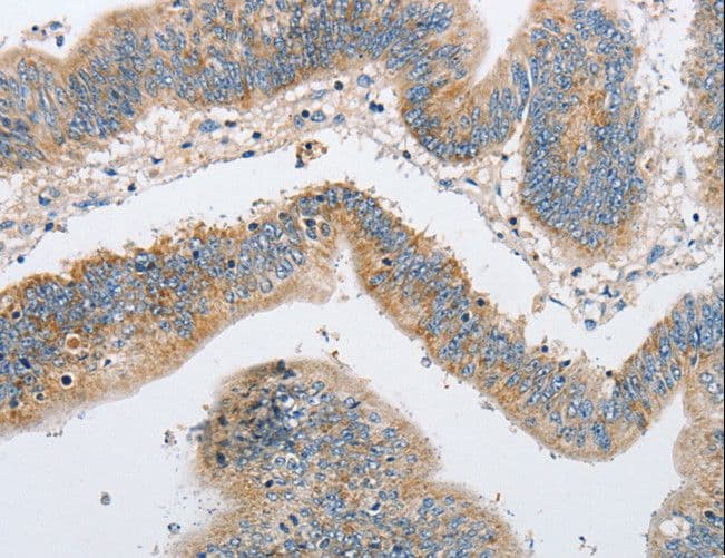 Polyclonal Rabbit anti-Human ARHGEF9 / Collybistin Antibody (IHC, WB)
