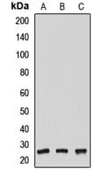 Polyclonal Rabbit anti-Human NUDT21 Antibody (WB)