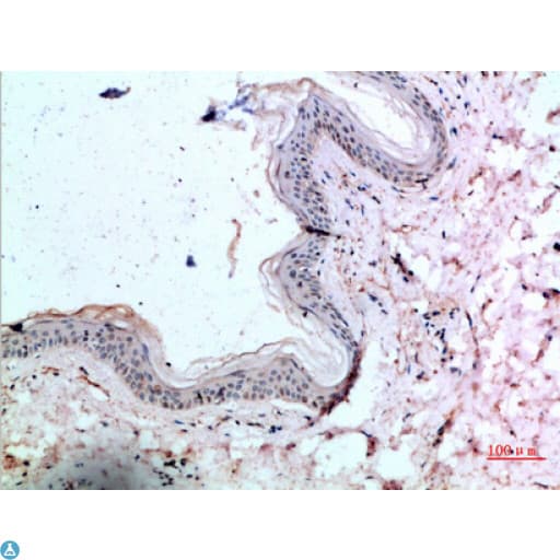 Polyclonal Rabbit anti-Human CTGF Antibody (IHC)