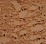 HTATSF1 / TAT-SF1 Antibody (aa1-30)