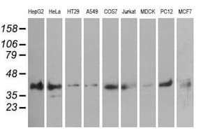 PIM2 / Pim-2 Antibody (clone OTI10A12)