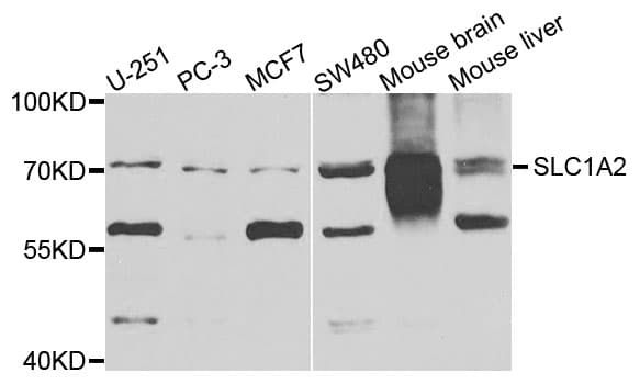 SLC1A2 / EAAT2 / GLT-1 Antibody (aa495-574)