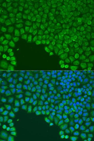 CDC42 Antibody