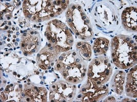 HDAC10 Antibody (clone OTI7C3)