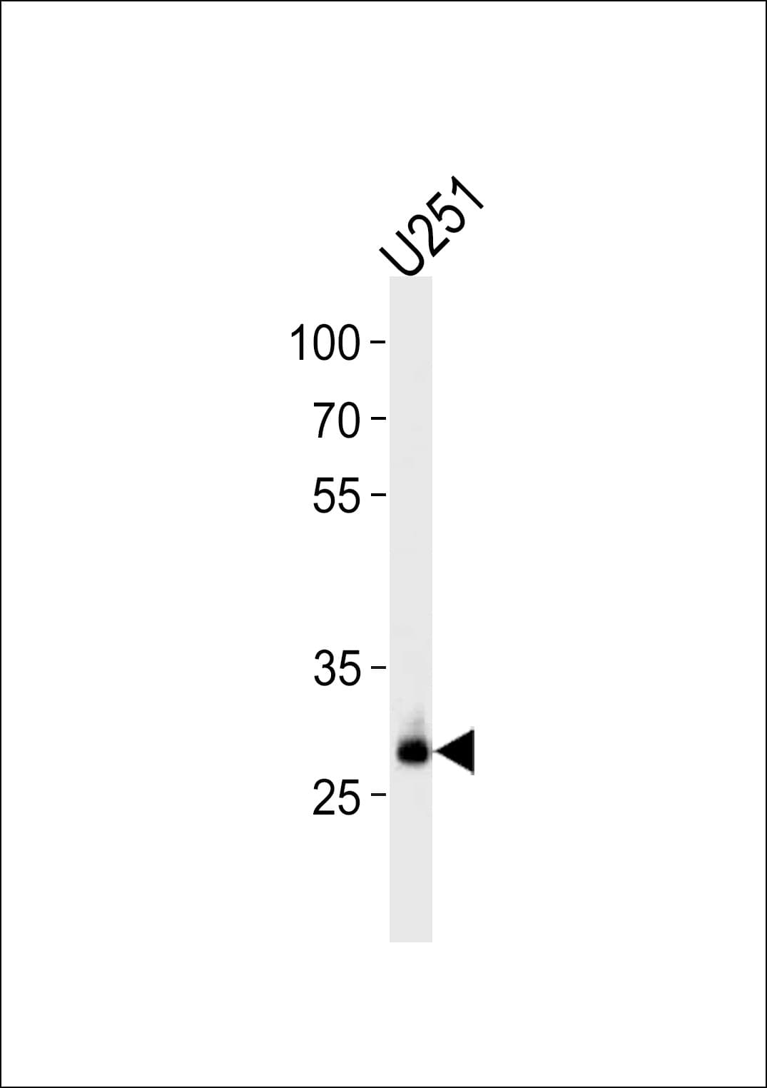 CNOT8 Antibody (aa227-255)
