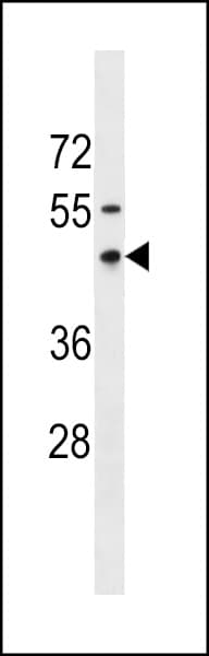 Polyclonal Rabbit anti-Human RNFT1 Antibody (aa1-30, WB)