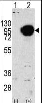 IHC-plus™ Polyclonal Rabbit anti-Human PYGM Antibody (aa698-727, IHC, WB)
