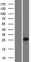 GSTT2B Protein (Over-Expression Lysate Myc-DDK (Flag))