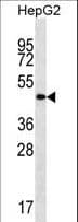 Polyclonal Rabbit anti-Human TMCC3 Antibody (aa133-162, IHC, WB)