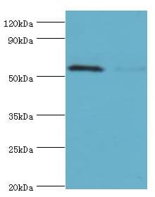 PAK2 Antibody (aa1-212)
