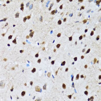 CCAR2 / KIAA1967 Antibody