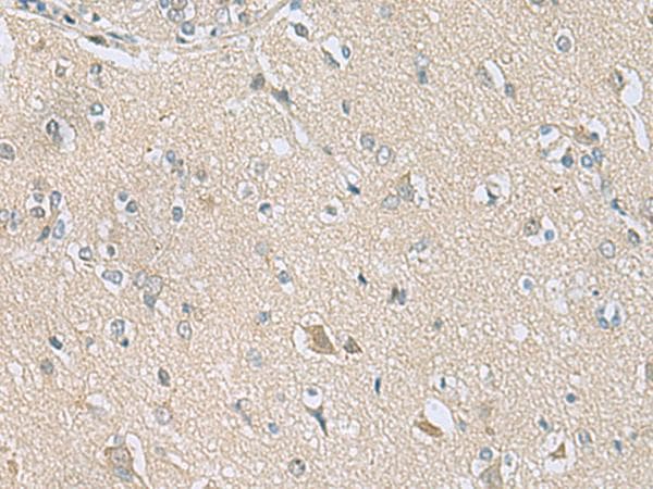 TSTA3 / GDP-L-Fucose Synthase Antibody