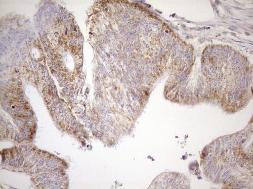 Monoclonal Mouse anti-Human SDHB Antibody (clone OTI3F5, IHC, WB)