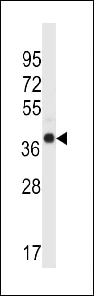 Polyclonal Rabbit anti-Human WDR89 Antibody (aa359-387, IHC, WB)