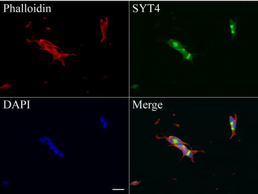 SYT4 Antibody (clone UMAB128)