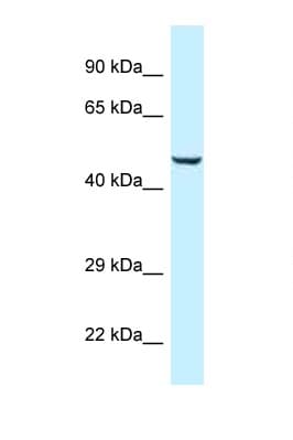 Polyclonal Rabbit anti-Human TRMO / C9orf156 Antibody (aa197-246, WB)