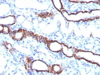 CDH16 / Cadherin 16 Antibody (clone CDH16/1532R, Azide-free, Carrier-free)