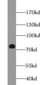 Polyclonal Rabbit anti-Human MAP3K3 / MEKK3 Antibody (IHC, WB)