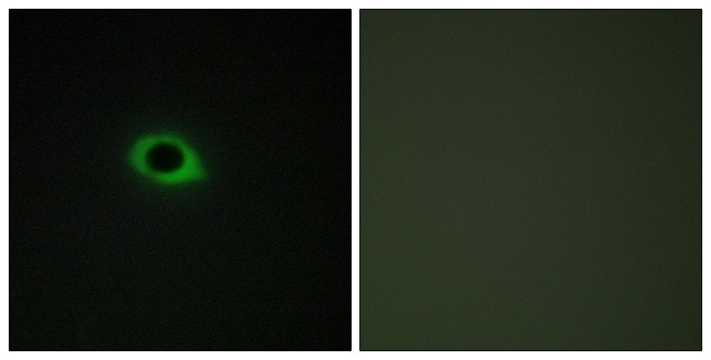 TNS3 / Tensin 3 Antibody