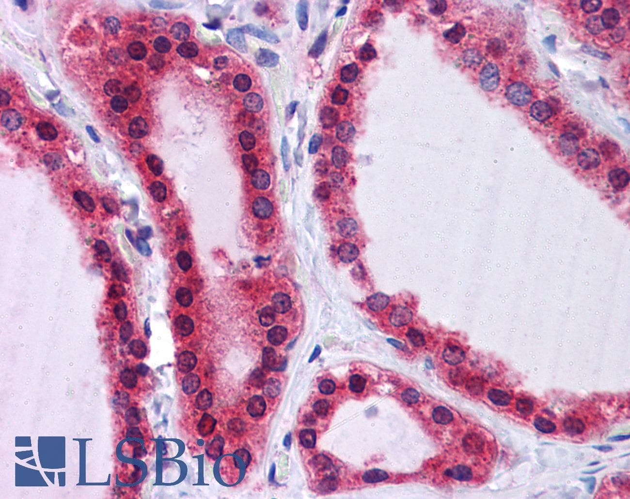 IHC-plus™ Polyclonal Rabbit anti-Human SCRN2 / Ses2 Antibody (IHC, IF, WB)