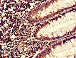 Polyclonal Rabbit anti-Human S100A10 Antibody