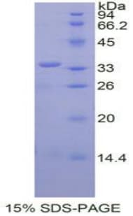 Mouse SPINK5 / LEKTI Protein (Recombinant His, N-Terminal)