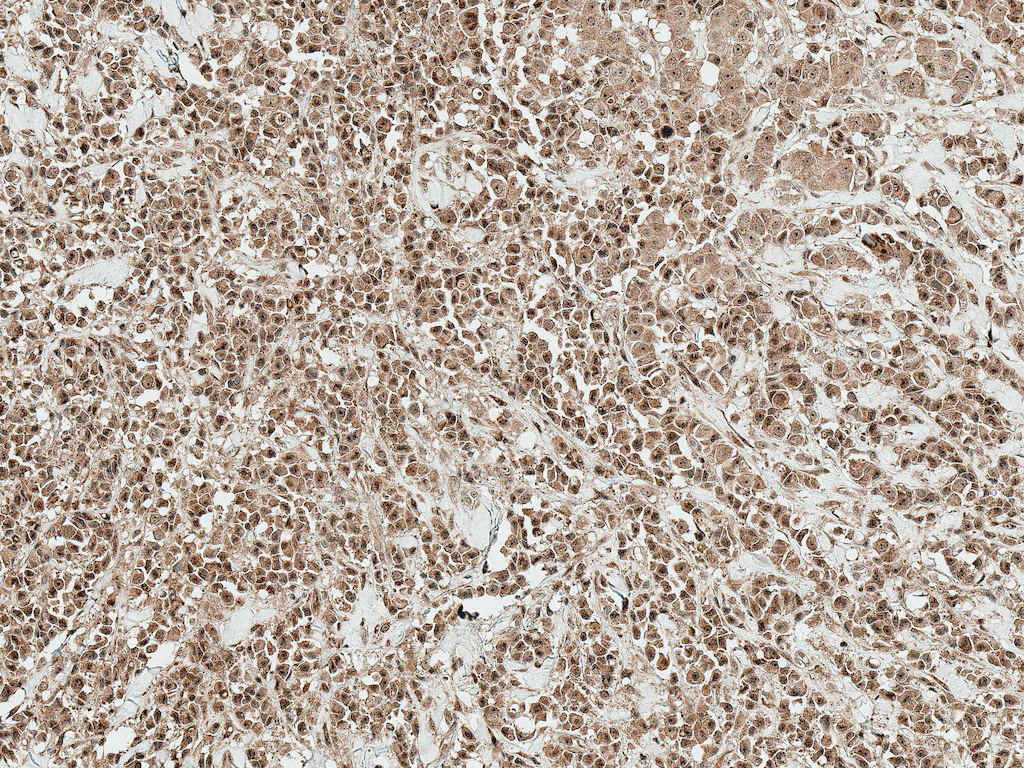 RYK Antibody (Atto 594)