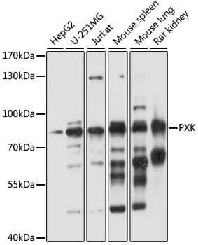 Polyclonal Rabbit anti-Human PXK Antibody (WB)
