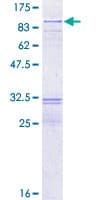 Human RECQ1 / RECQL Protein (Recombinant GST)