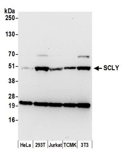 SCLY Antibody (aa395-445)
