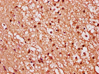 Polyclonal Rabbit anti-Human FGF1 / Acidic FGF Antibody (aa16-155, IHC)
