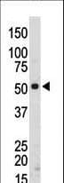 Polyclonal Rabbit anti-Human SRMS Antibody (aa456-485, IHC, WB)