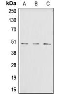 Polyclonal Rabbit anti-Human GLUL / Glutamine Synthetase Antibody (Internal, WB)