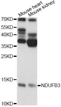Polyclonal Rabbit anti-Human NDUFB3 Antibody (WB)