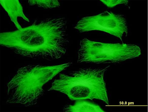IHC-plus™ TUBB2A / Tubulin Beta 2A Antibody (clone 3B2)