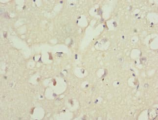 Polyclonal Rabbit anti-Human PPP2R1B Antibody (IHC, WB)